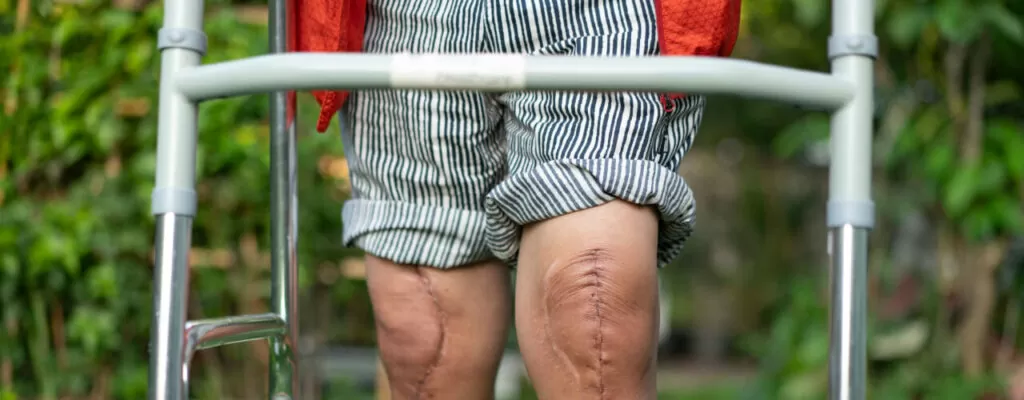 Knee Surgery solution in Lansdale